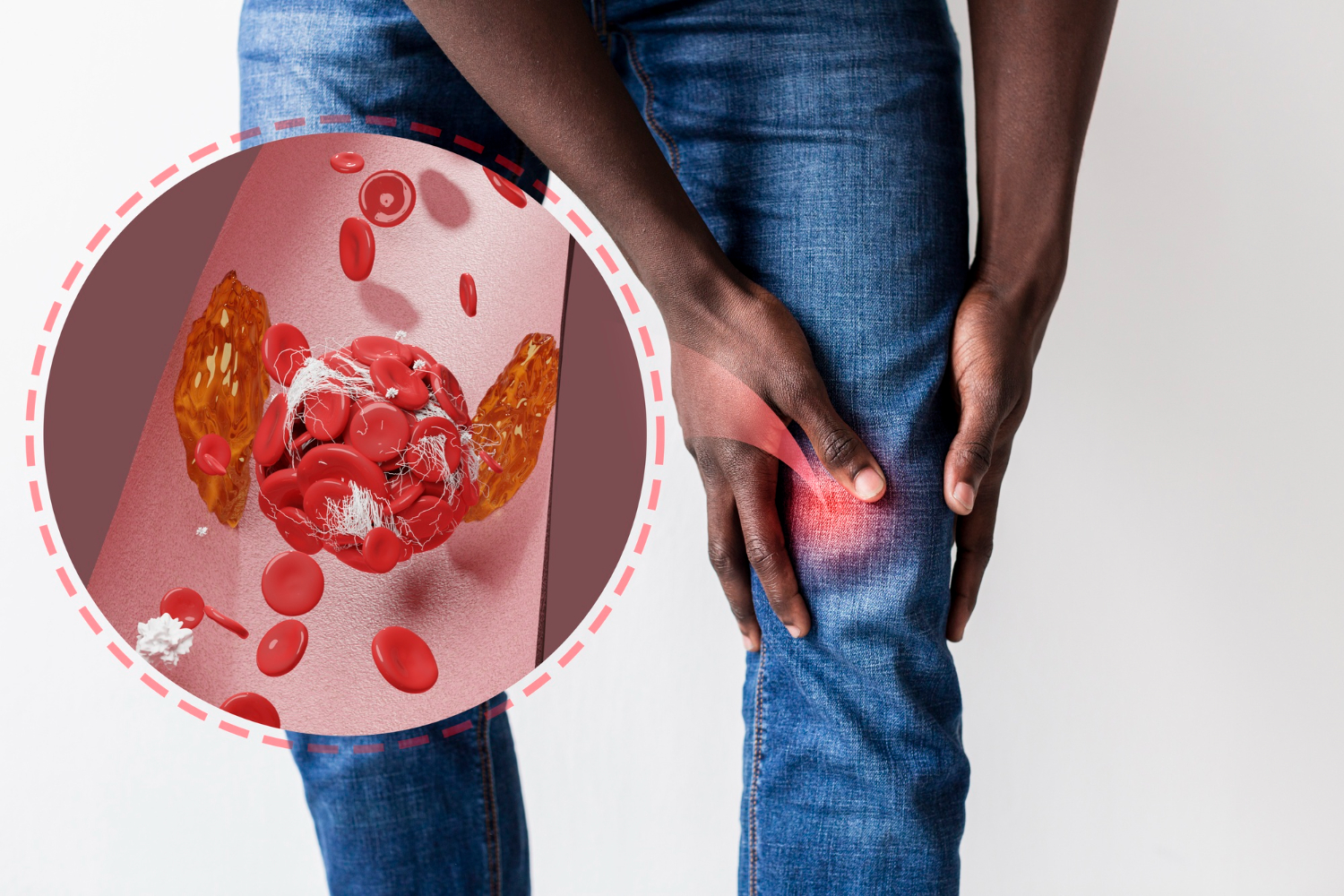 Overactive Bladder: Causes, Symptoms, and Management