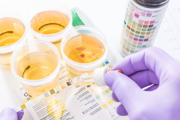 Understanding Urine: The Secrets to Your Body’s Well-Being!